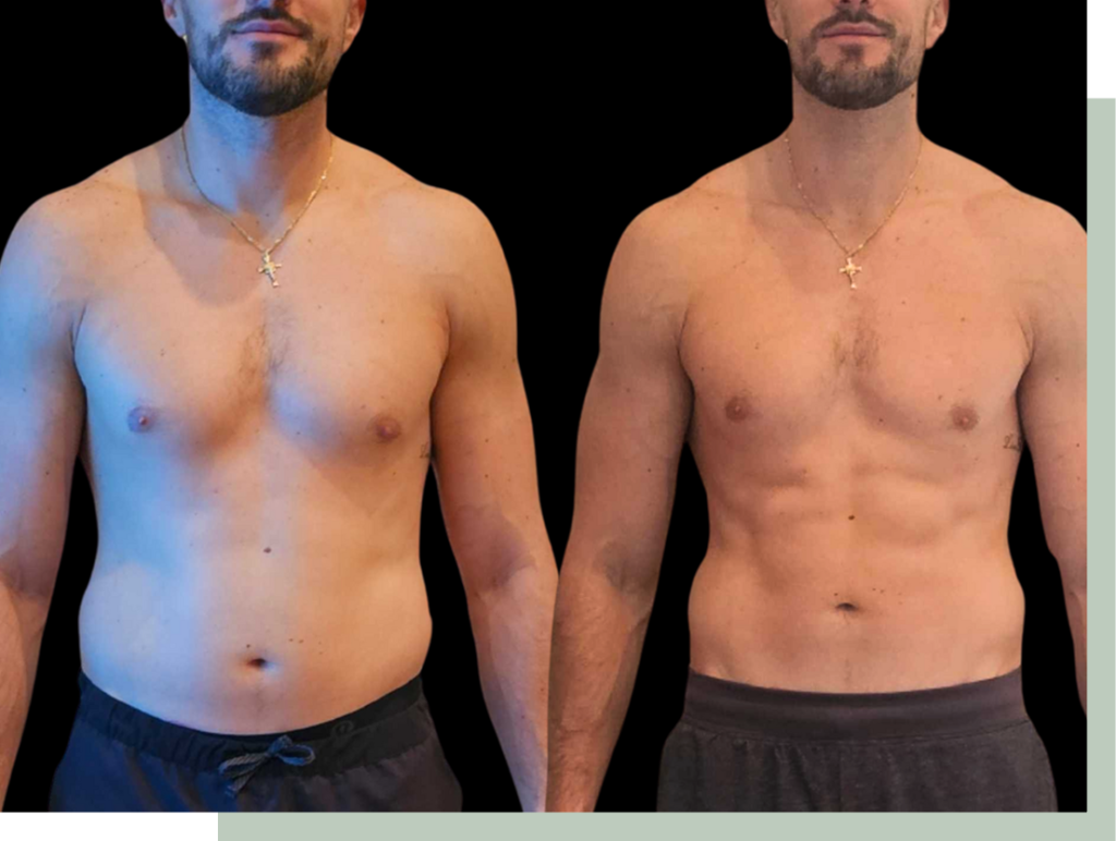 ozempic perte de poids témoignage